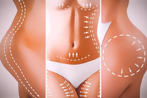 Cirurgia Plástica
