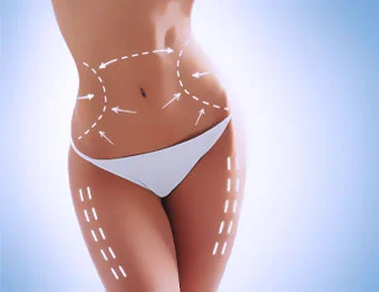 Tire Suas Dúvidas Sobre Abdominoplastia