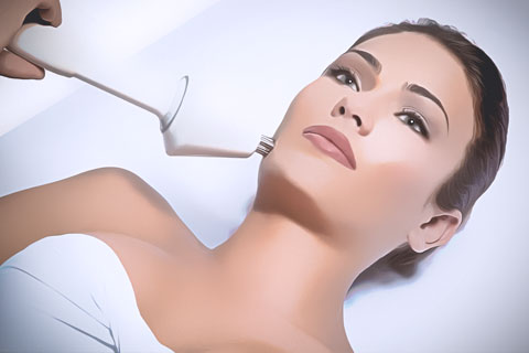 Radiofrequência para Flacidez