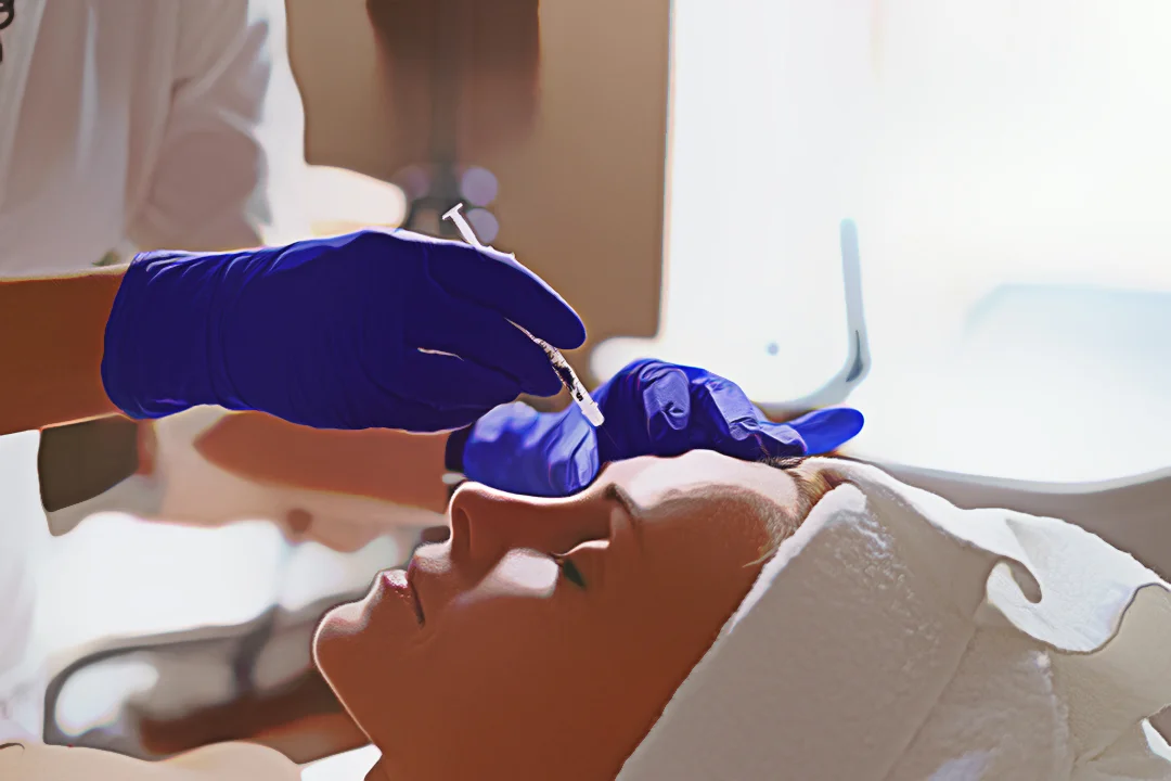 Quanto Tempo Dura o Efeito da Toxina Botulínica?